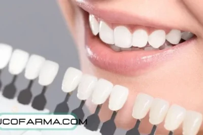¿Cuánto dura un blanqueamiento dental